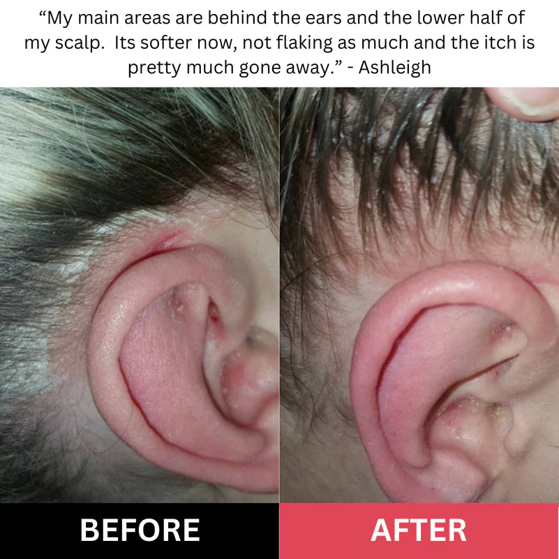 Luvia - Scalp Scrub