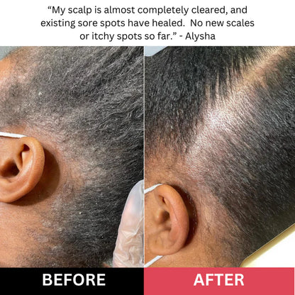 Luvia - Scalp Scrub
